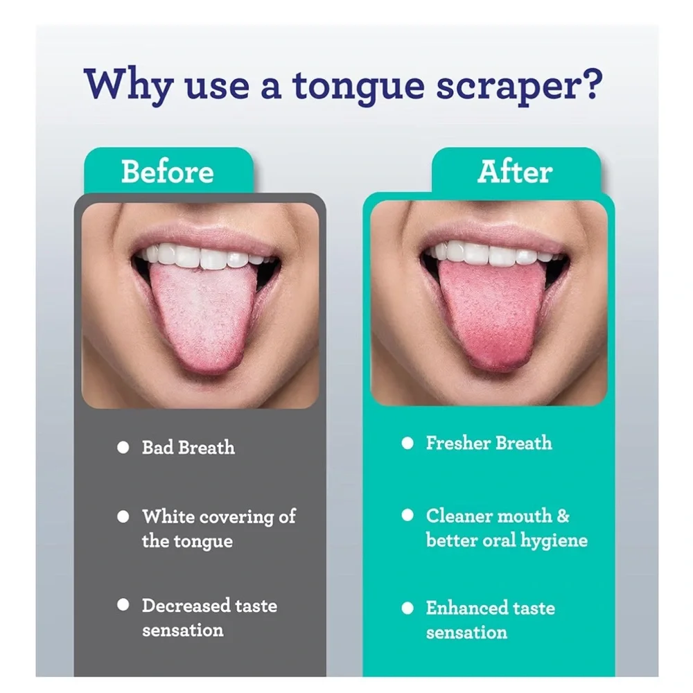 GuruNanda Spoon Shaped Stainless Steel Tongue Scraper
